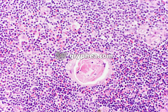 Thymus avec Corps de Hassal x100 - gryphea.com